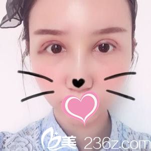 術(shù)后一周 術(shù)后一周