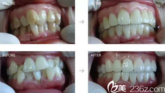 王家順牙齒矯正 王家順牙齒矯正