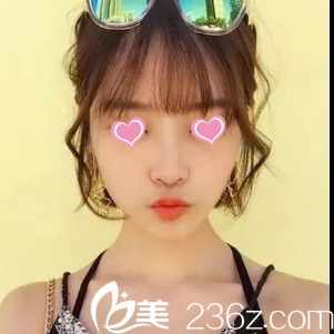 贛州儷人吳中望給妹子做了隆鼻手術，大家看看效果怎么樣？