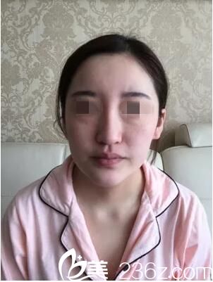 術(shù)前照片 術(shù)前照片