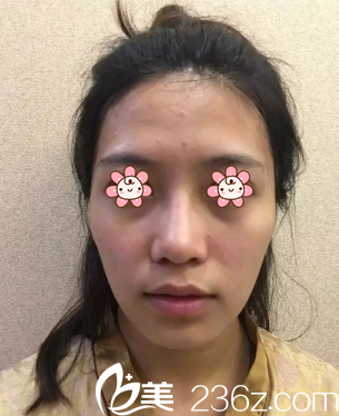 閨蜜介紹我去了重慶時光整形美容醫(yī)院面診 閨蜜介紹我去了重慶時光整形美容醫(yī)院面診