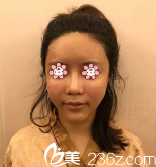 術(shù)后即刻 術(shù)后即刻