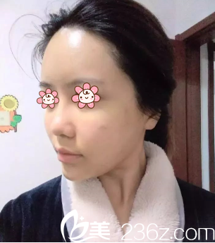 范眉清醫(yī)生給我做完第二天 范眉清醫(yī)生給我做完第二天