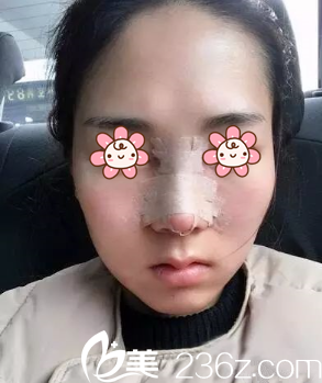 單磊醫(yī)生給我做完手術(shù)后第二天 單磊醫(yī)生給我做完手術(shù)后第二天