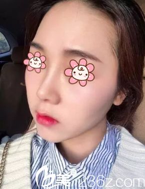 鼻綜合10天 鼻綜合10天