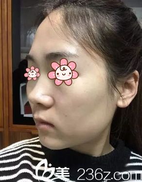 這是我去重慶華美整形美容醫(yī)院之前拍的 這是我去重慶華美整形美容醫(yī)院之前拍的