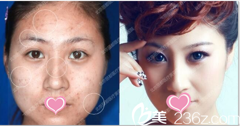 治療前后對比照 治療前后對比照