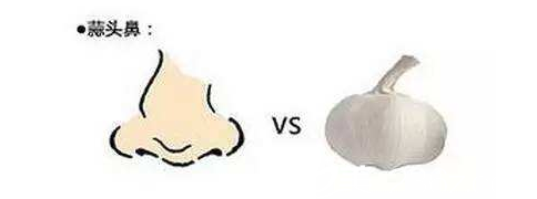 什么是蒜頭鼻