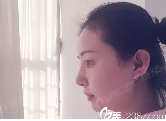 術(shù)后七天拆線恢復(fù)中