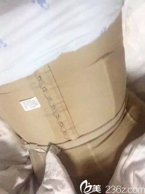 腰腹部吸脂后穿塑形衣的照片