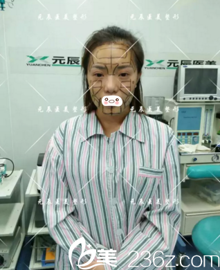 術(shù)前設(shè)計(jì)劃線