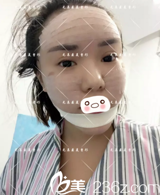 術(shù)后天效果