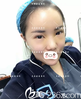 第五天恢復(fù)情況