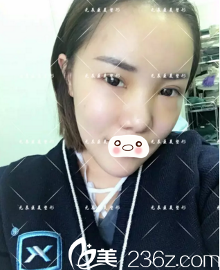 術(shù)后第六天情況