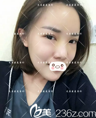 術(shù)后第八天恢復(fù)效果