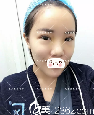 第十天的效果情況