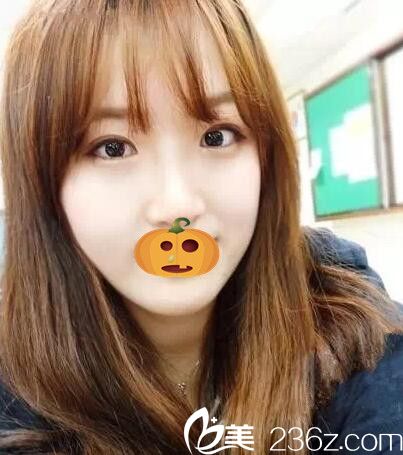 是焦作麗人讓我擁有了迷人大眼和高挺鼻子 花這錢做眼鼻整形真值