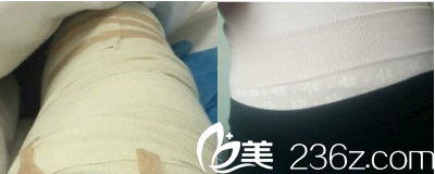 王女士治療第三天的樣子