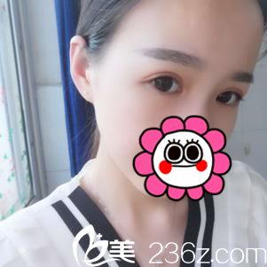 術(shù)后十天恢復(fù)效果 術(shù)后十天恢復(fù)效果