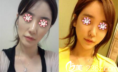 南書宇醫(yī)師面部年輕化案例