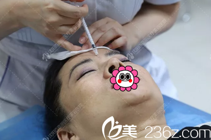 注射玻尿酸填充皺紋 注射玻尿酸填充皺紋