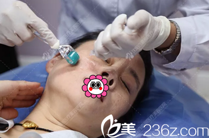 做微針淡化面部色斑 做微針淡化面部色斑