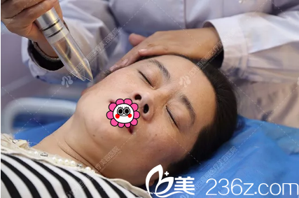 激光提升面部肌膚彈性 激光提升面部肌膚彈性