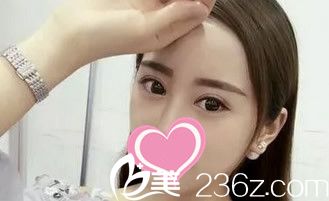 割雙眼皮半個(gè)月了 割雙眼皮半個(gè)月了