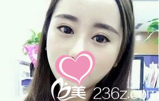 術(shù)后19天 術(shù)后19天