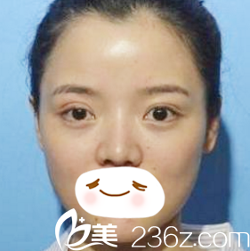 手術(shù)前 手術(shù)前