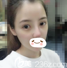 術(shù)后一周拆線 術(shù)后一周拆線