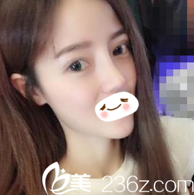 術(shù)后二十天恢復(fù)情況 術(shù)后二十天恢復(fù)情況