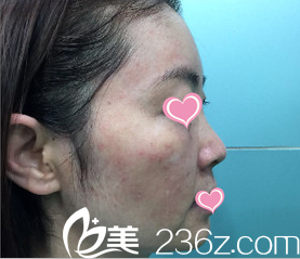 之前照片 之前照片