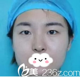 手術(shù)前的我 手術(shù)前的我