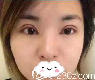 術(shù)后第四天 術(shù)后第四天