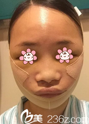 林贊洙院長(zhǎng)給我術(shù)后第三天