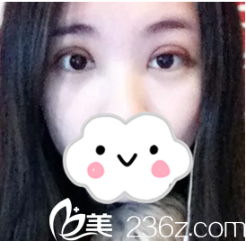 術(shù)后第五天 術(shù)后第五天