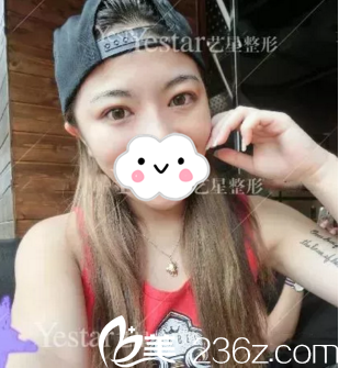 術(shù)后21天 術(shù)后21天