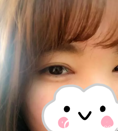 手術(shù)后第20天