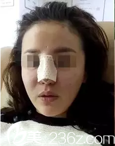 術(shù)后當(dāng)天的我 術(shù)后當(dāng)天的我