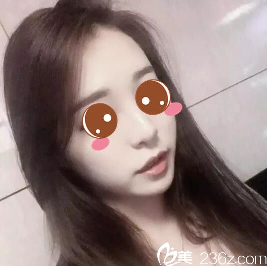 韓國BE&ME樸晉弘韓式半紋眉真人案例術(shù)后第三天