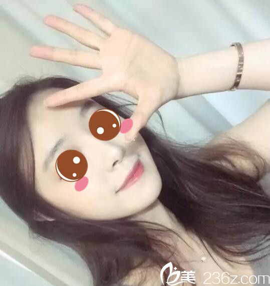 韓國BE&ME樸晉弘韓式半紋眉真人案例術(shù)后第七天