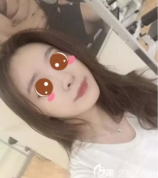 韓國BE&ME樸晉弘韓式半紋眉真人案例術(shù)后一個(gè)月