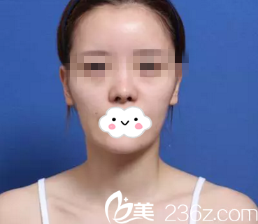 手術(shù)前的我 手術(shù)前的我