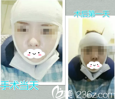 術(shù)后天 術(shù)后天