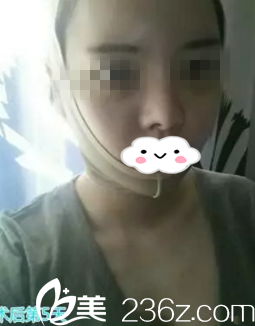 術(shù)后第五天 術(shù)后第五天