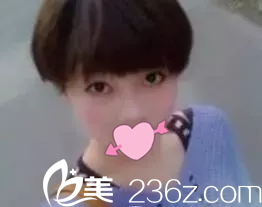 手術(shù)正面照 手術(shù)正面照