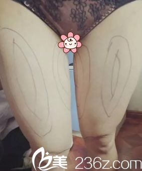 去重慶美侖美奐整形醫(yī)院面診