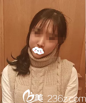 術(shù)后兩周 術(shù)后兩周