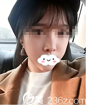 株洲華美改變了我的面部不對稱，讓我的美麗無可挑剔